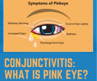 Pink eye: What it is and how to treat it